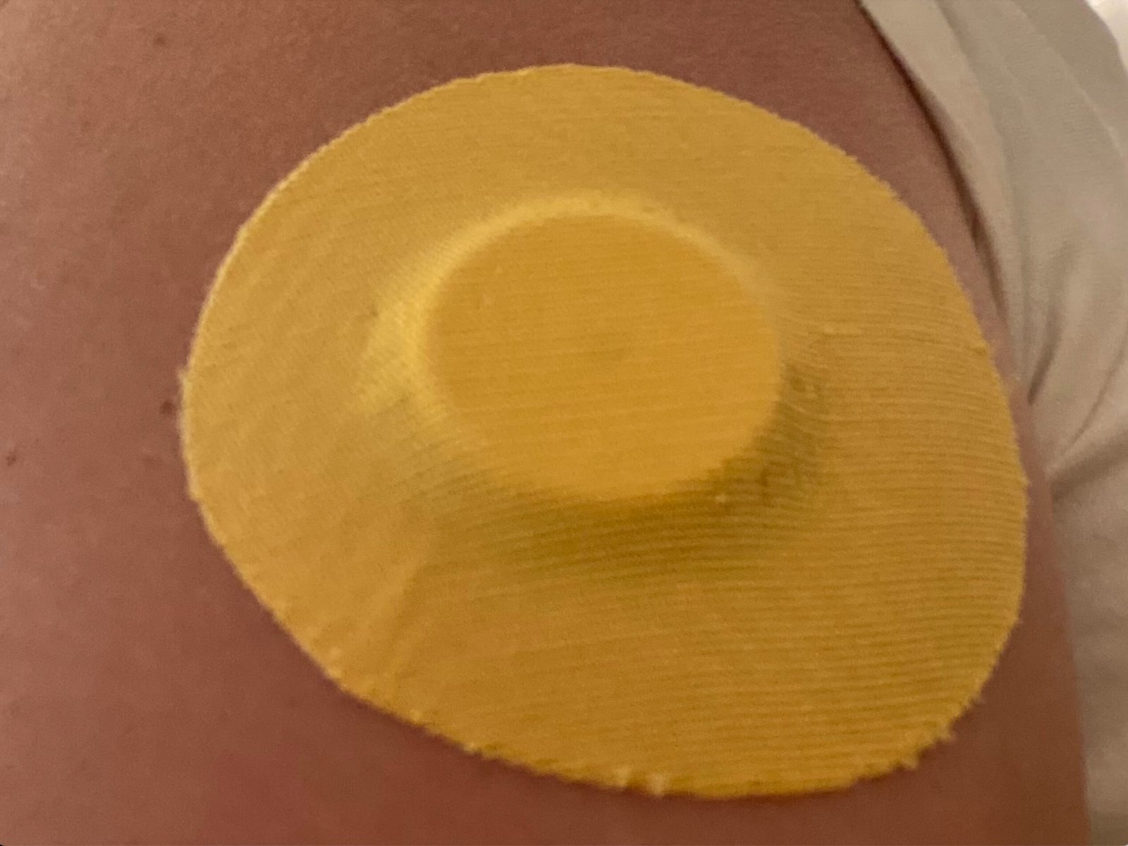 Read more about the article Skin Grip’s Adhesive Patches